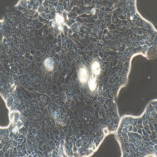 Calu-3 人肺腺癌细胞