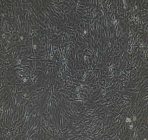 Ⅱ型肺泡上皮细胞