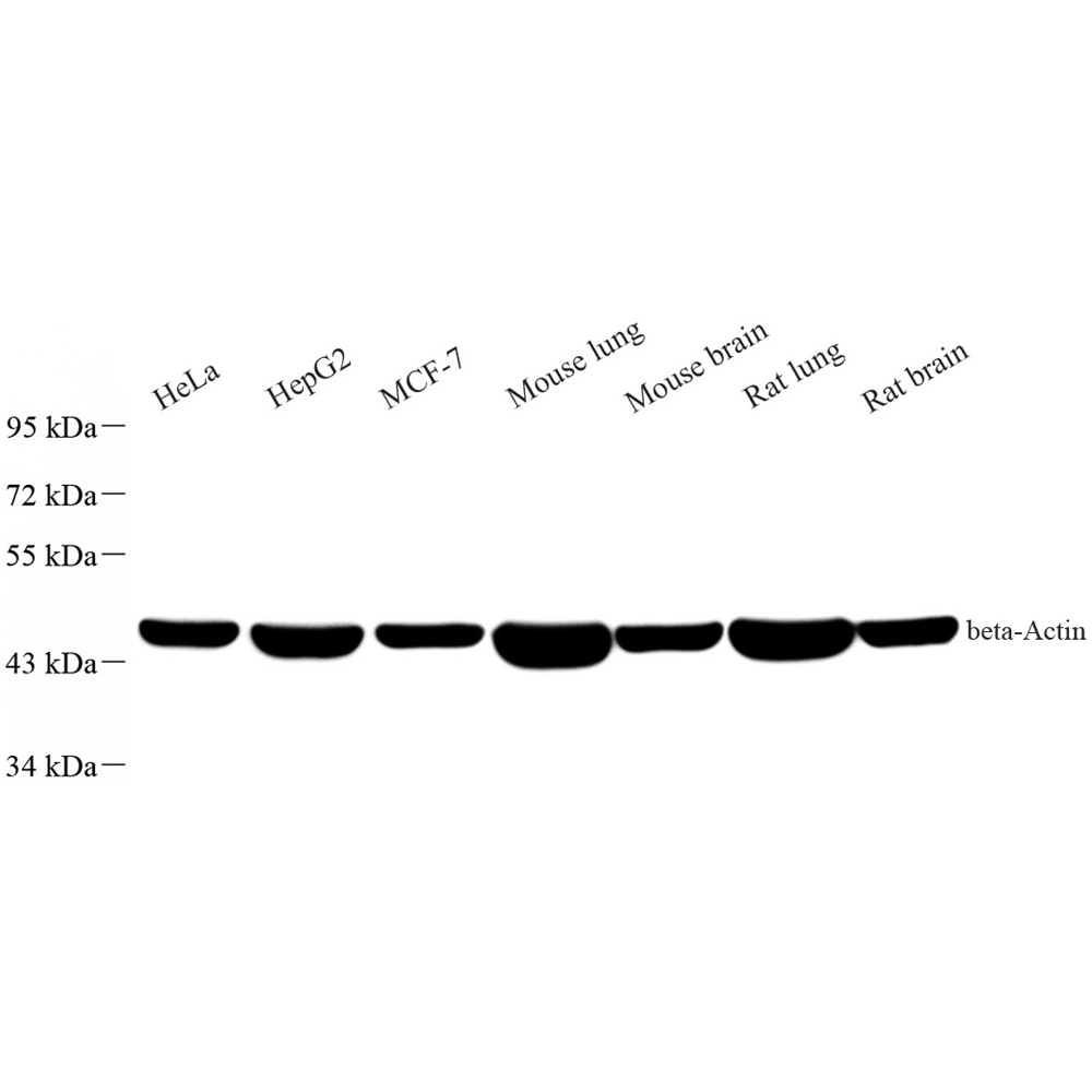 Recombinant Anti - beta Actin antibody ( Mouse mAb )