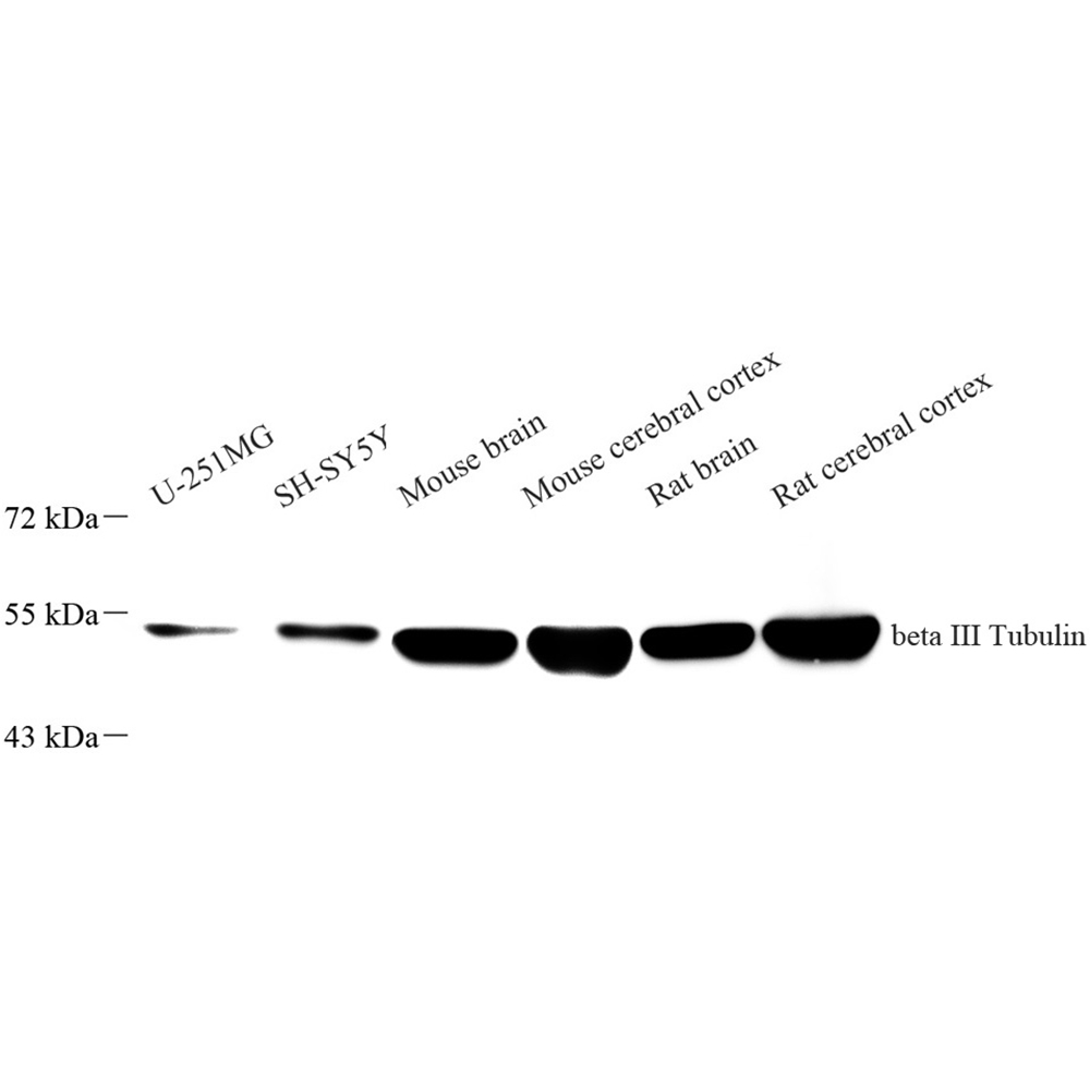 Recombinant Anti - beta Actin antibody ( Rabbit mAb )