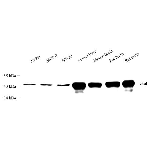 Anti -Glutamine Synthetase Mouse mAb