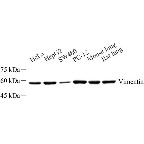 Anti -Vimentin Rabbit pAb