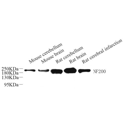 Anti -Neurofilament heavy polypeptide Rabbit pAb