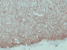 Anti -Myelin Basic Protein Mouse mAb