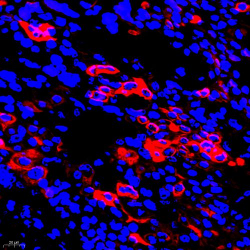 Anti -Cytokeratin 6 Rabbit pAb