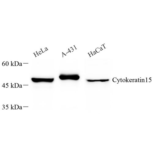 Anti -Cytokeratin 15 Rabbit pAb