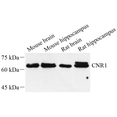 Anti -Cannabinoid Receptor I Rabbit pAb