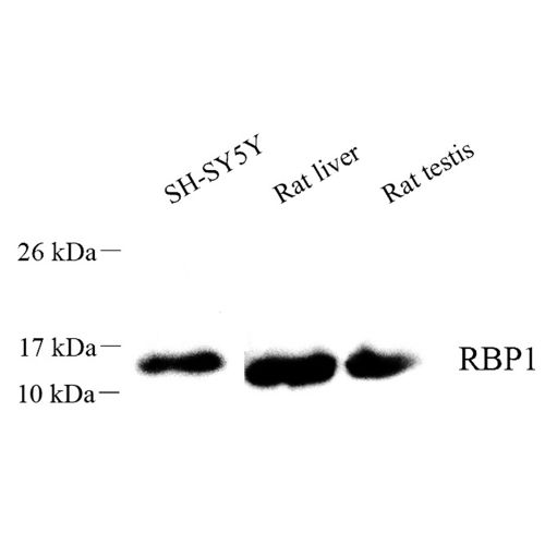 Anti -RBP1 Rabbit pAb